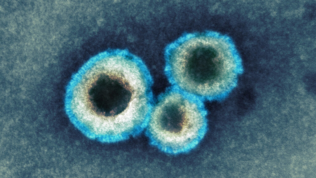 virus 1