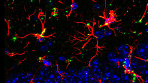 Molecula alzheimer